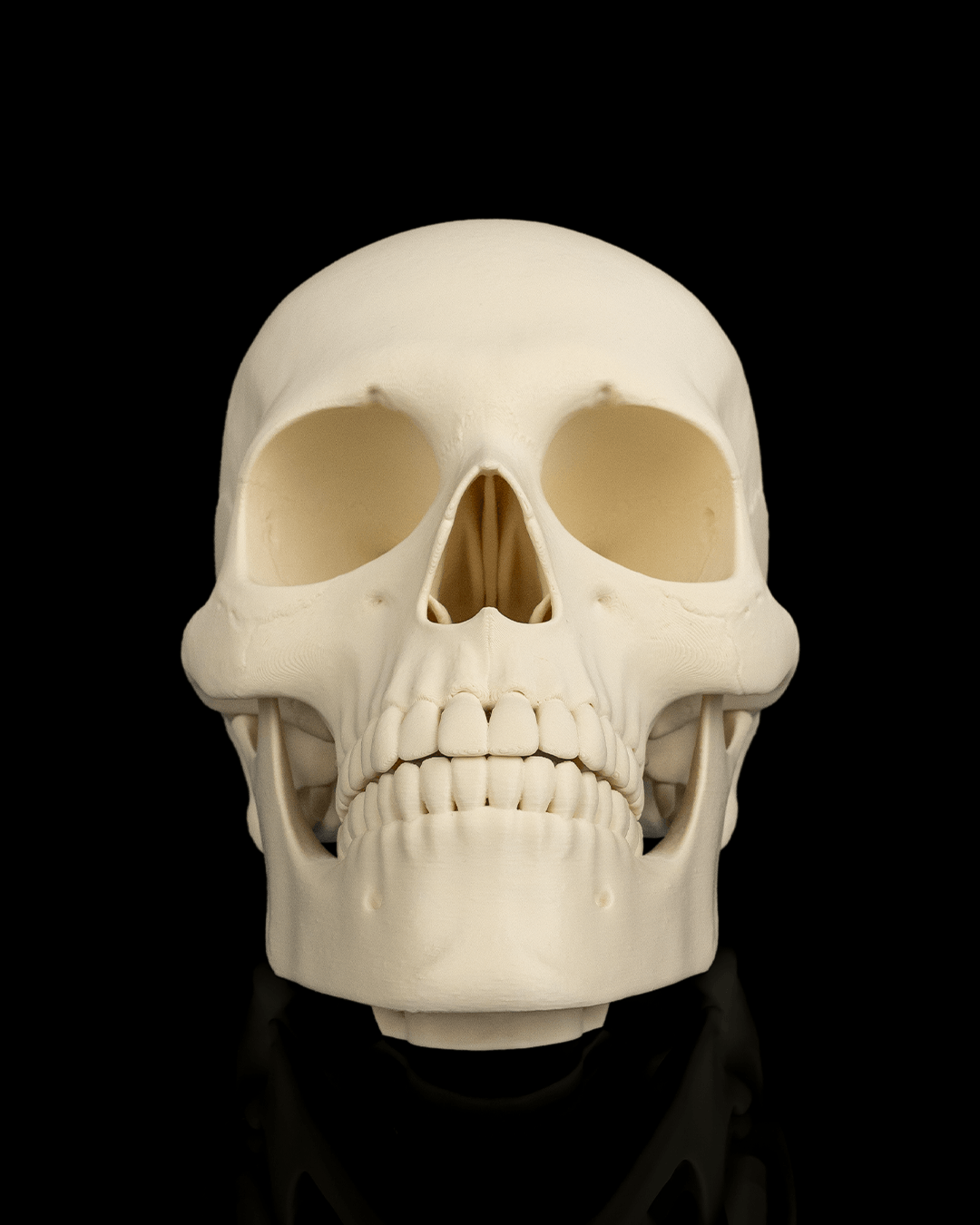 4237 - Cranium