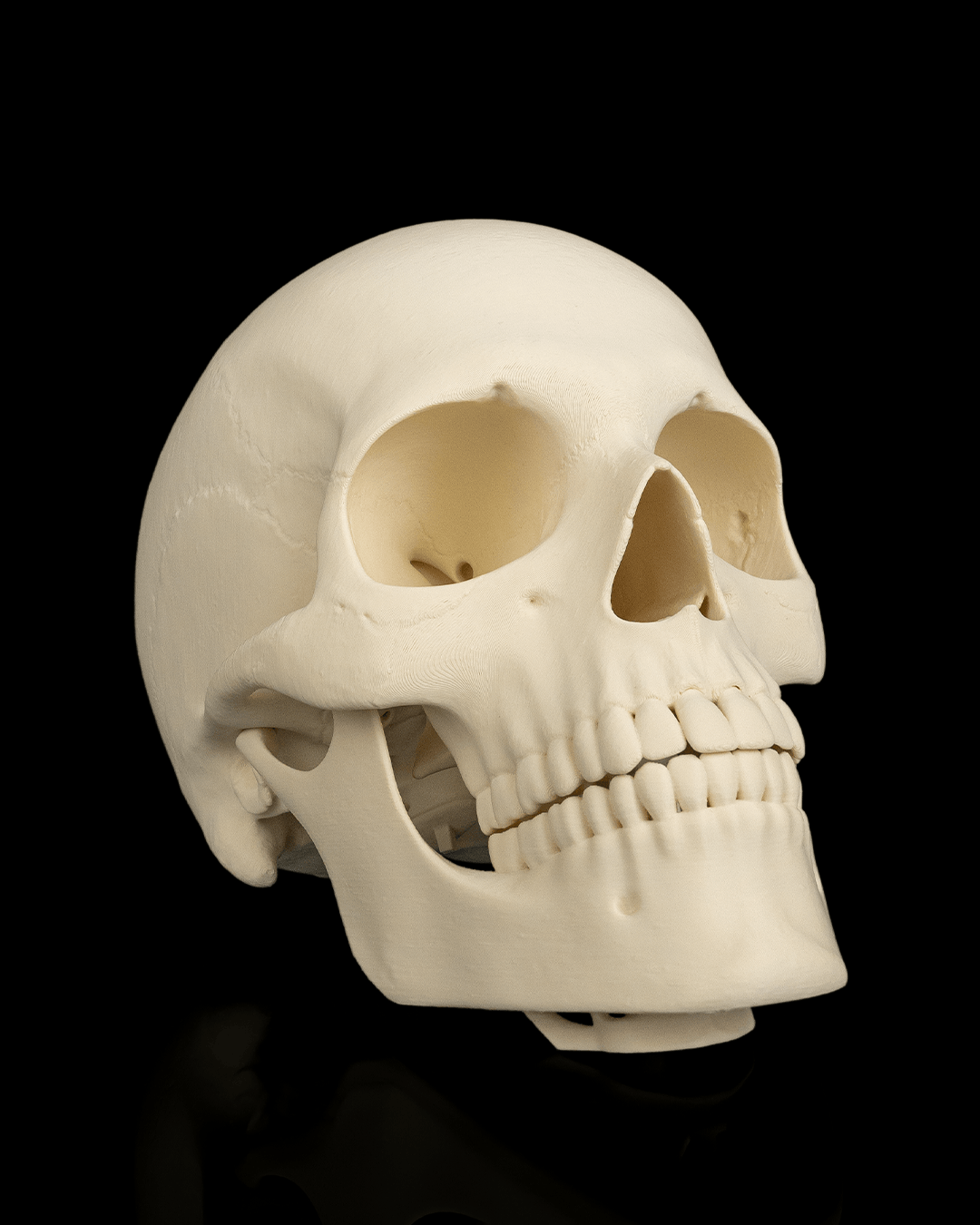 4237 - Cranium