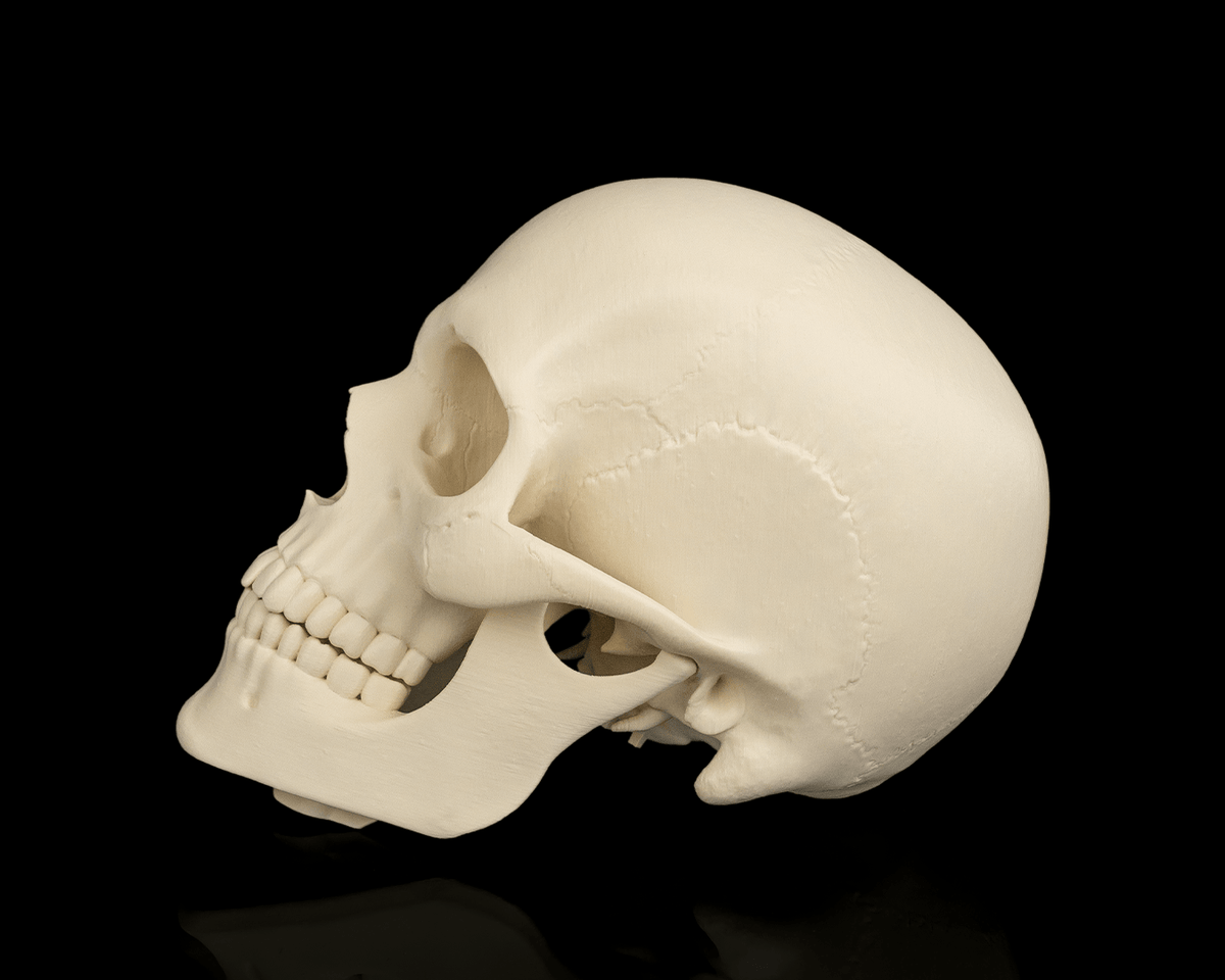 4237 - Cranium