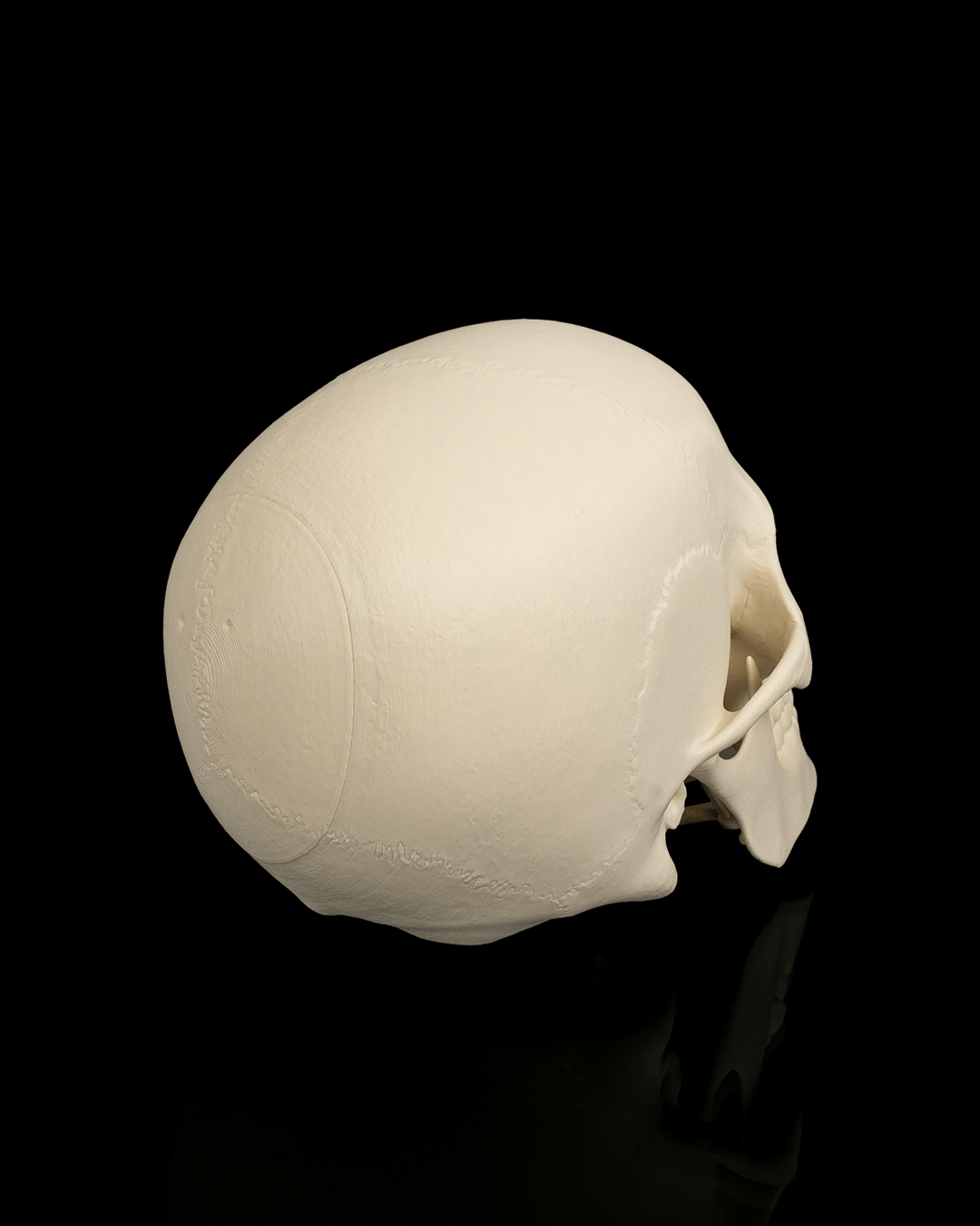 4237 - Cranium
