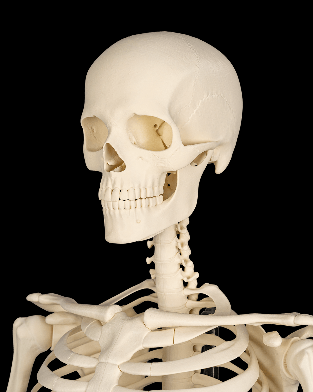 4237 - Cranium