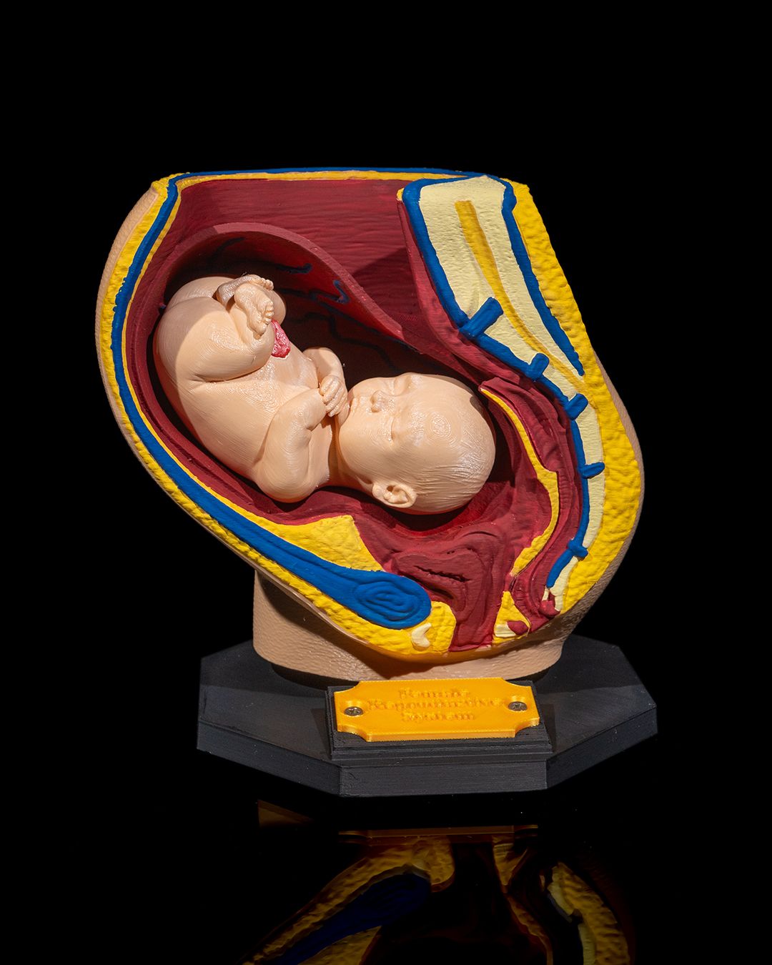 1527 - Female Reproductive System