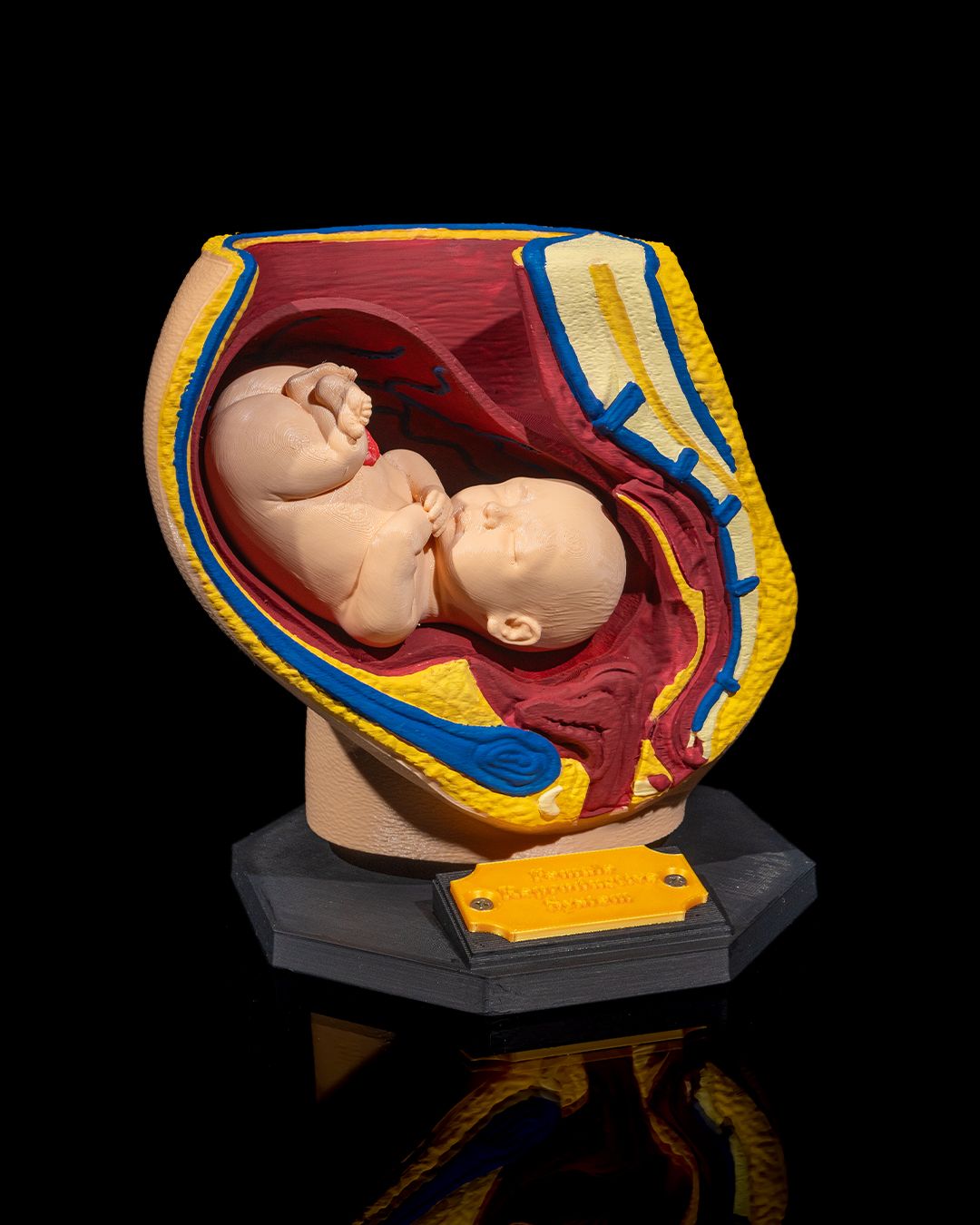 1527 - Female Reproductive System