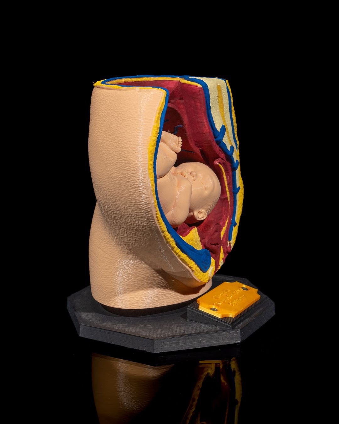 1527 - Female Reproductive System