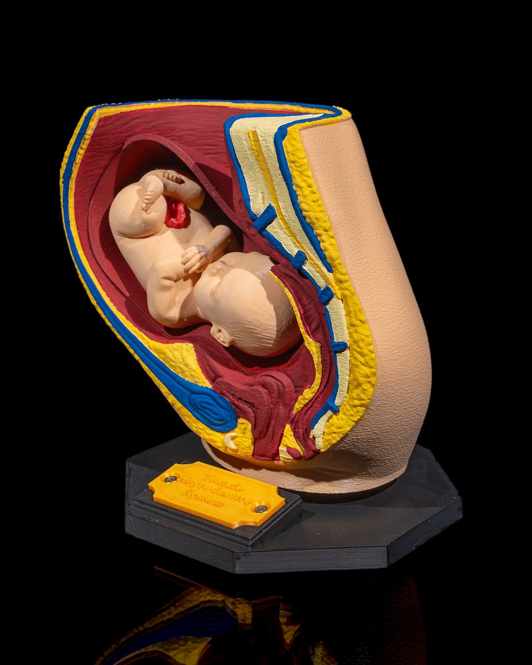 1527 - Female Reproductive System