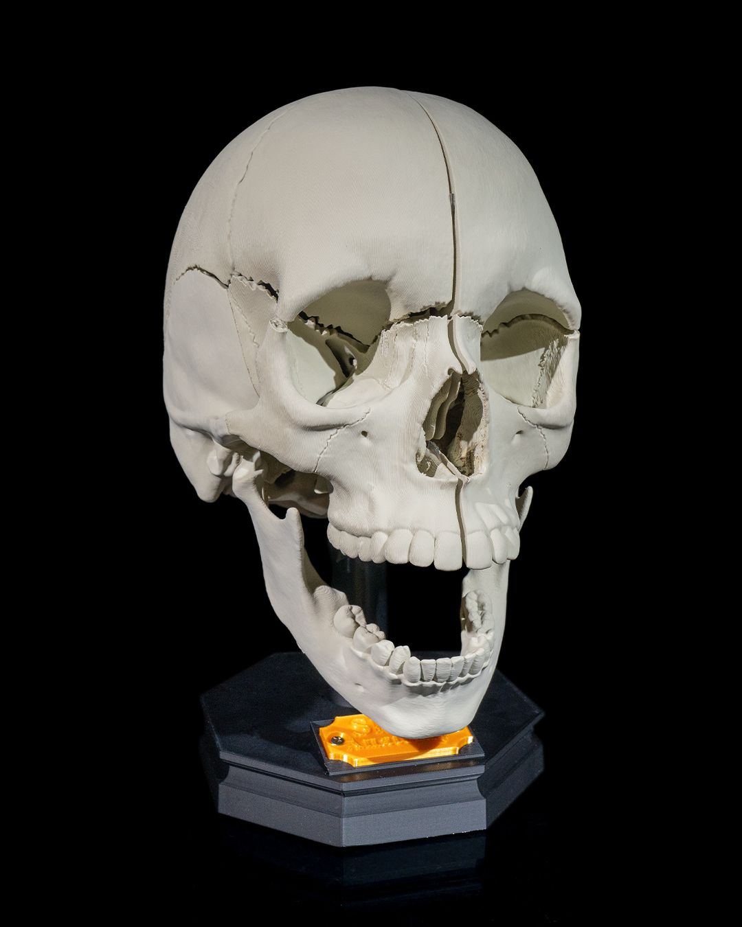1271 - Human Adult Skull