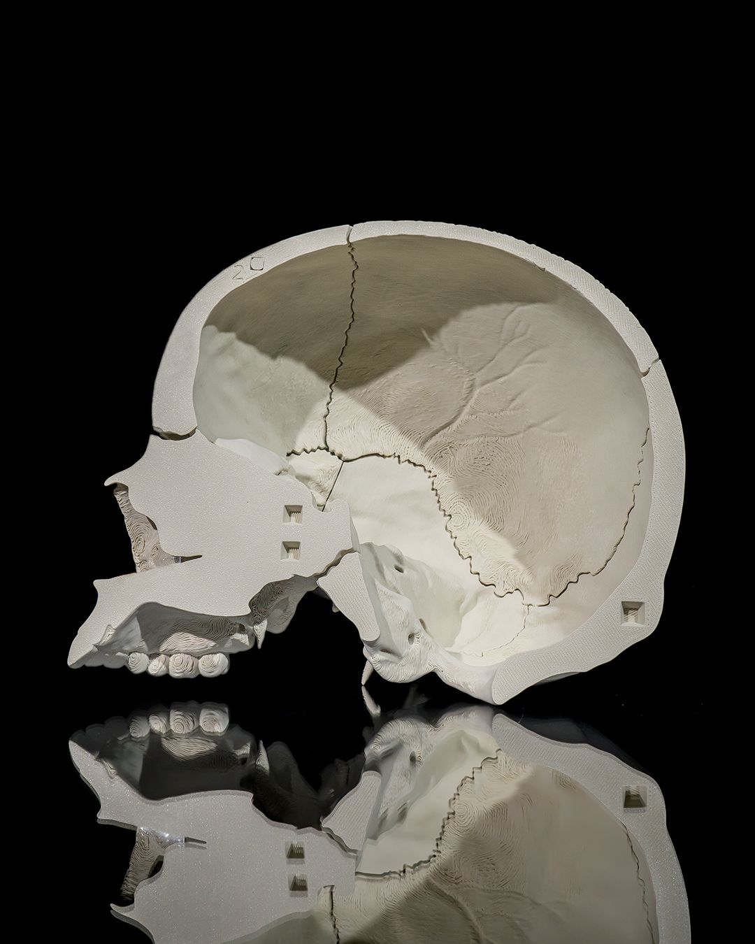 1271 - Human Adult Skull