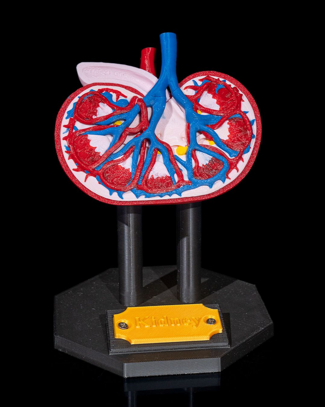 1394 - Kidney Anatomical Model