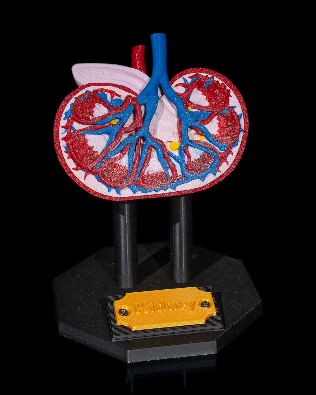 1394 - Kidney Anatomical Model