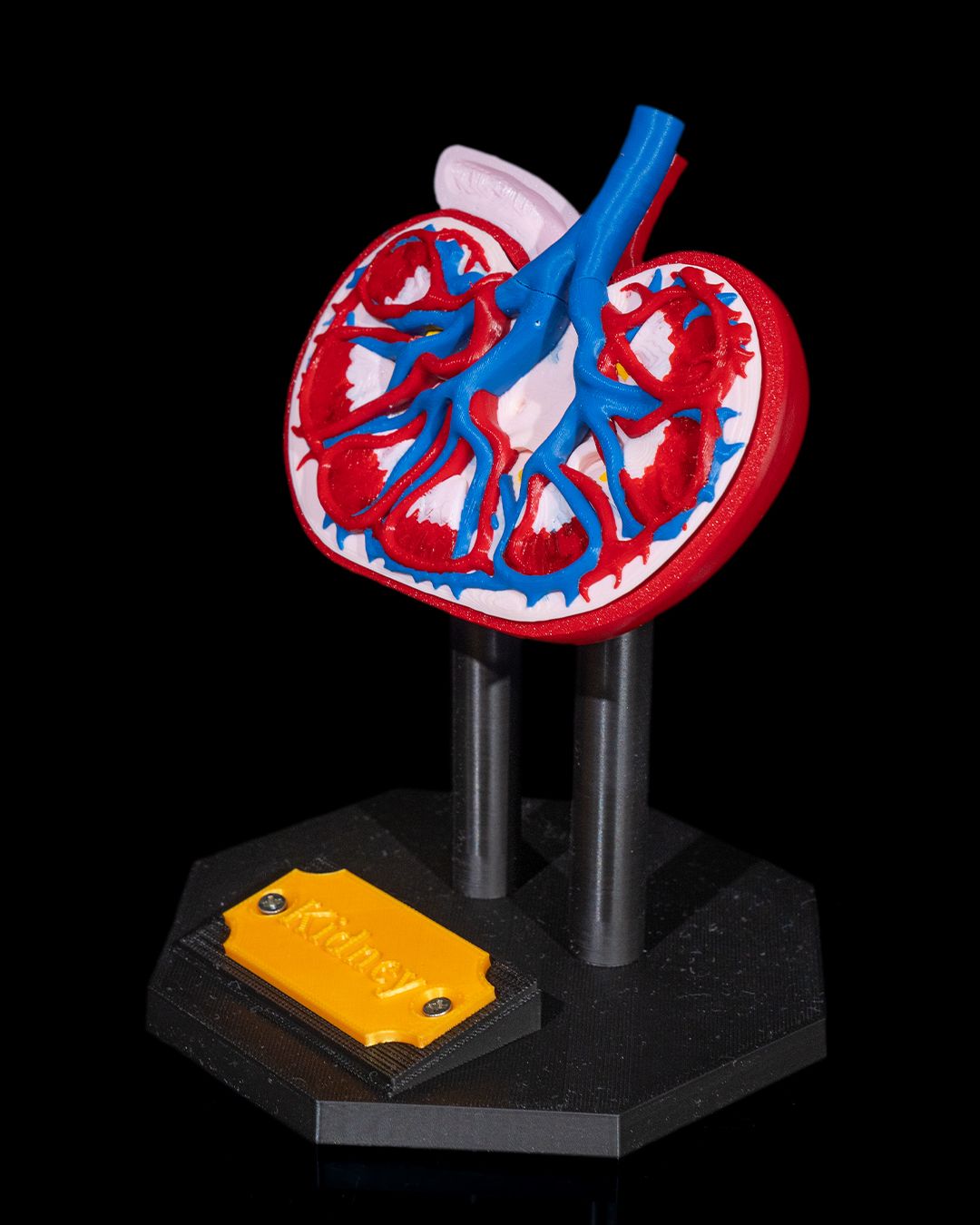 1394 - Kidney Anatomical Model