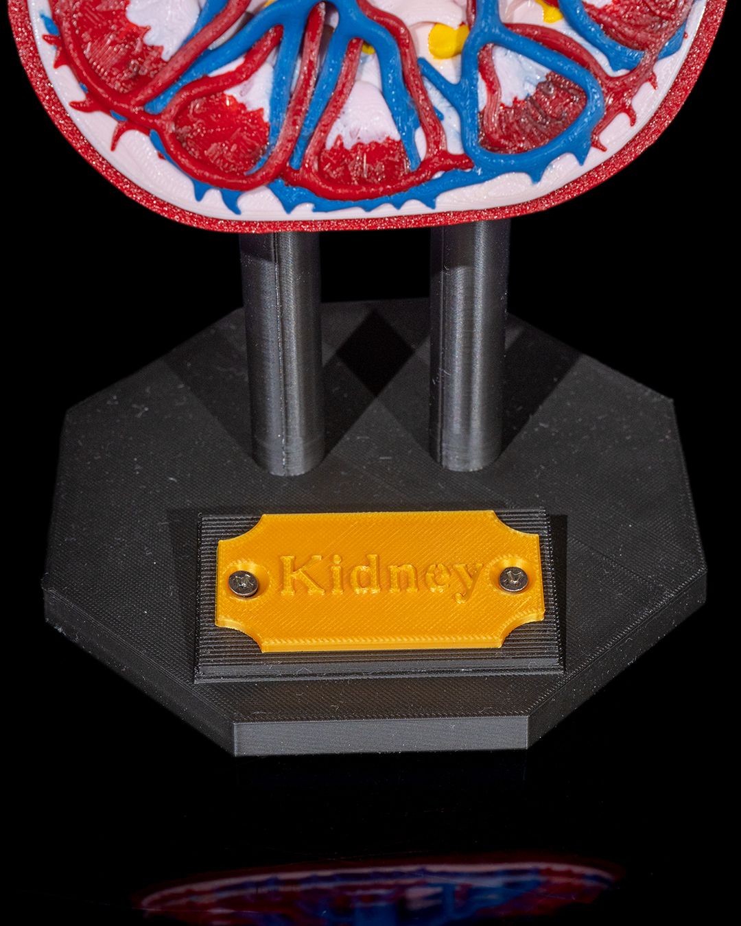 1394 - Kidney Anatomical Model