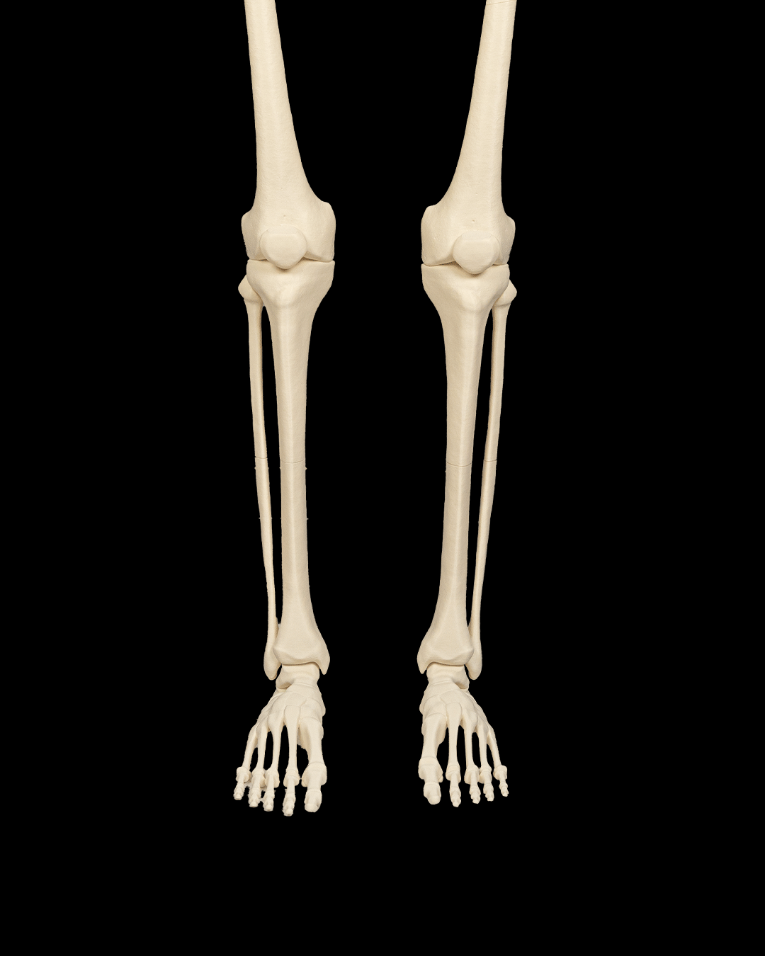 4241 - Lower Limb