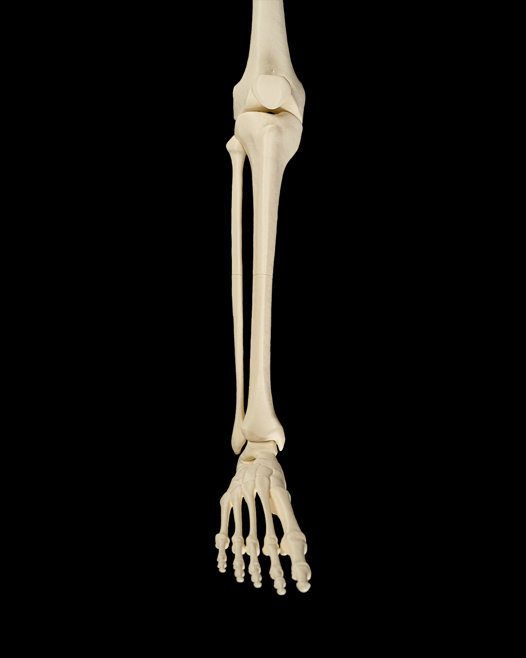 4241 - Lower Limb