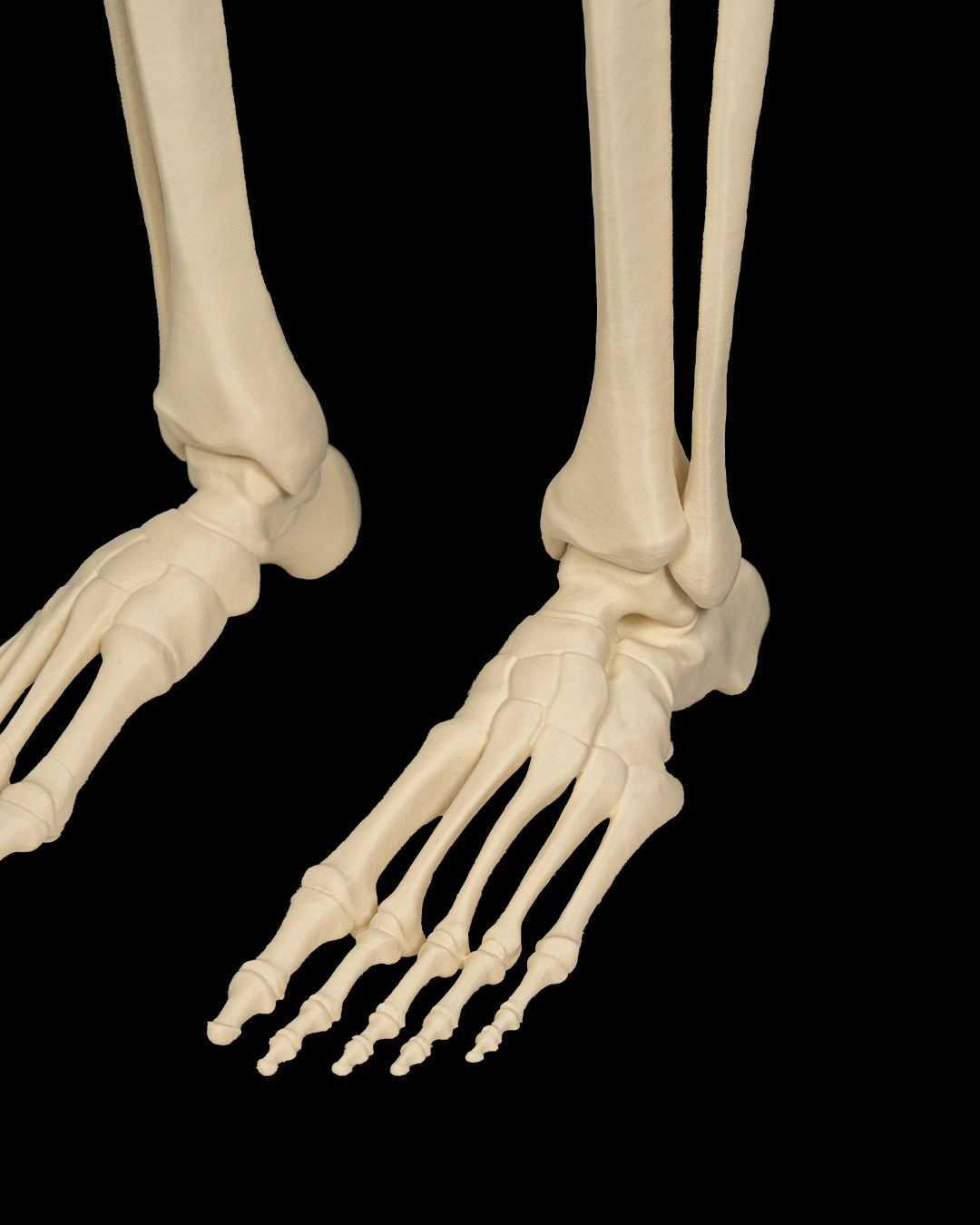 4241 - Lower Limb