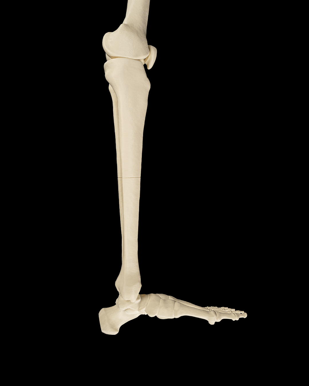 4241 - Lower Limb