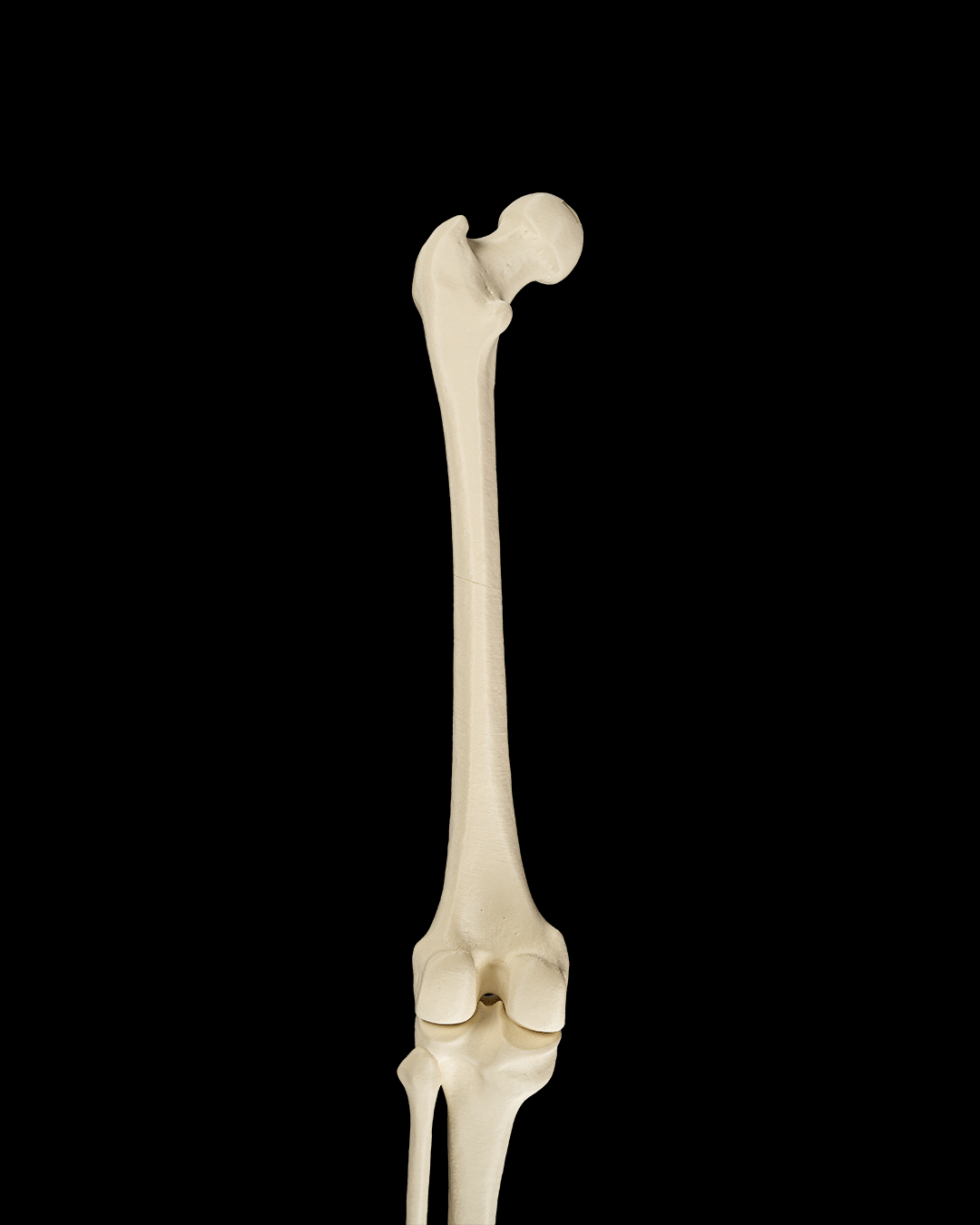 4241 - Lower Limb