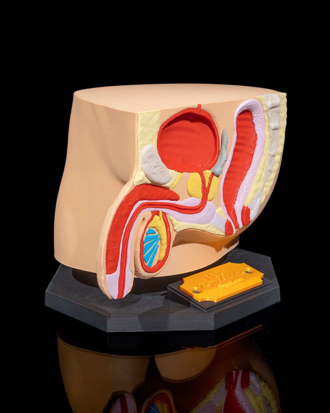 1528 - Male Reproductive System