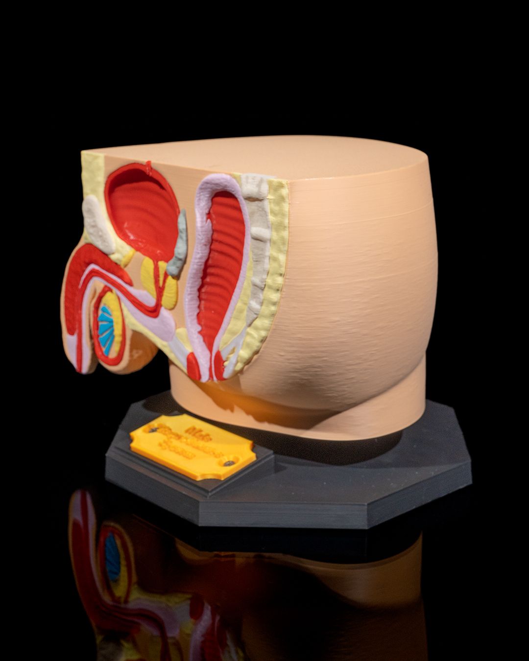 1528 - Male Reproductive System