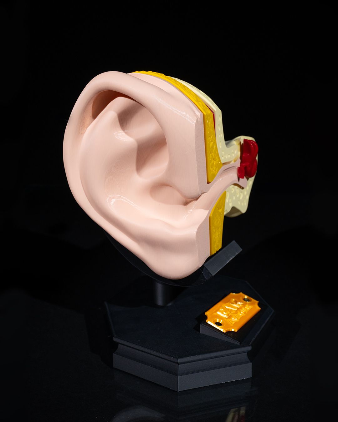 1267 - Outer and Inner Ear