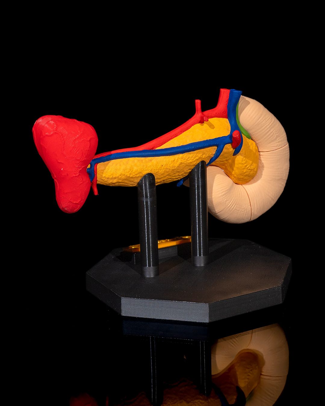 1393 - Pancreas Anatomical Model