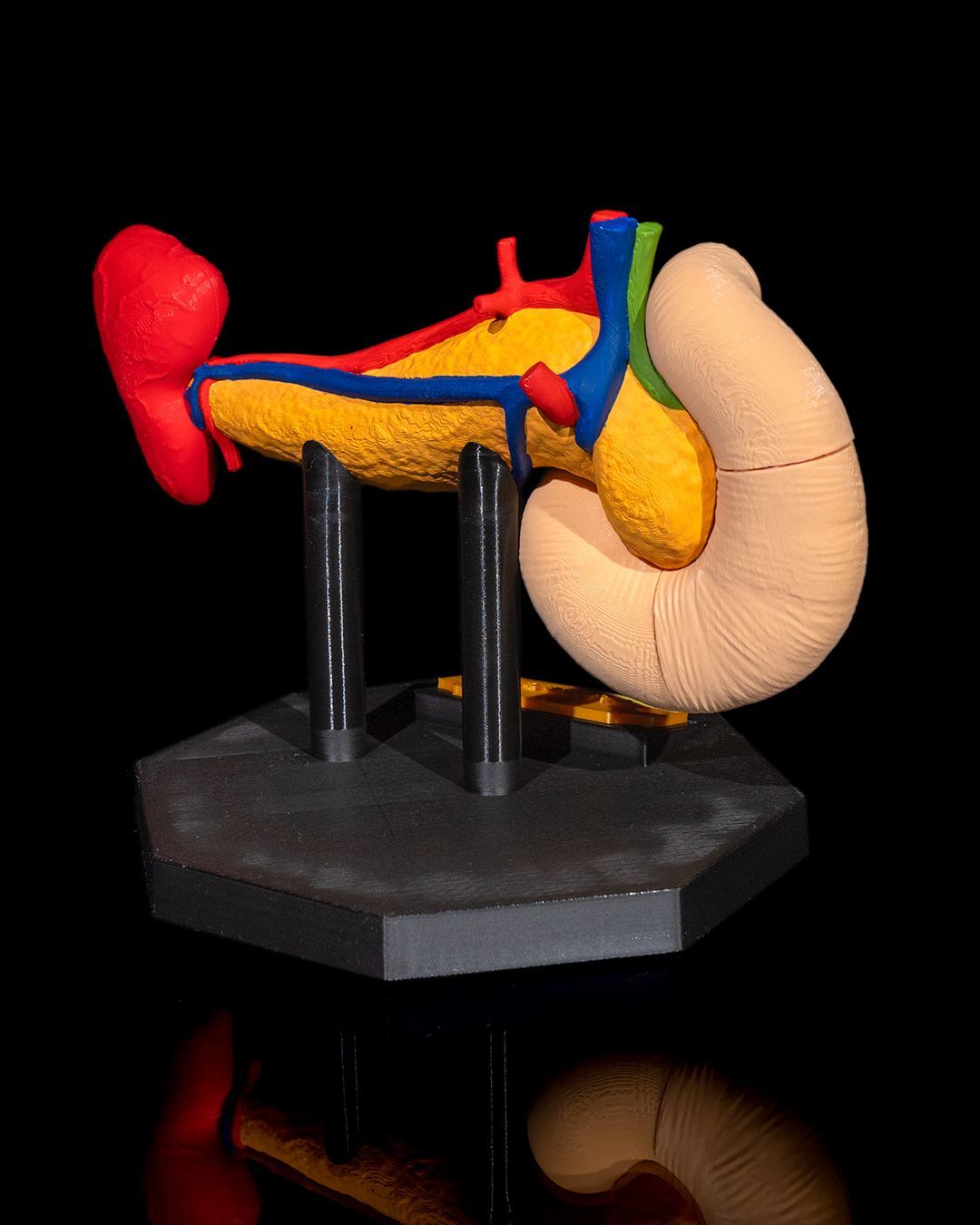 1393 - Pancreas Anatomical Model