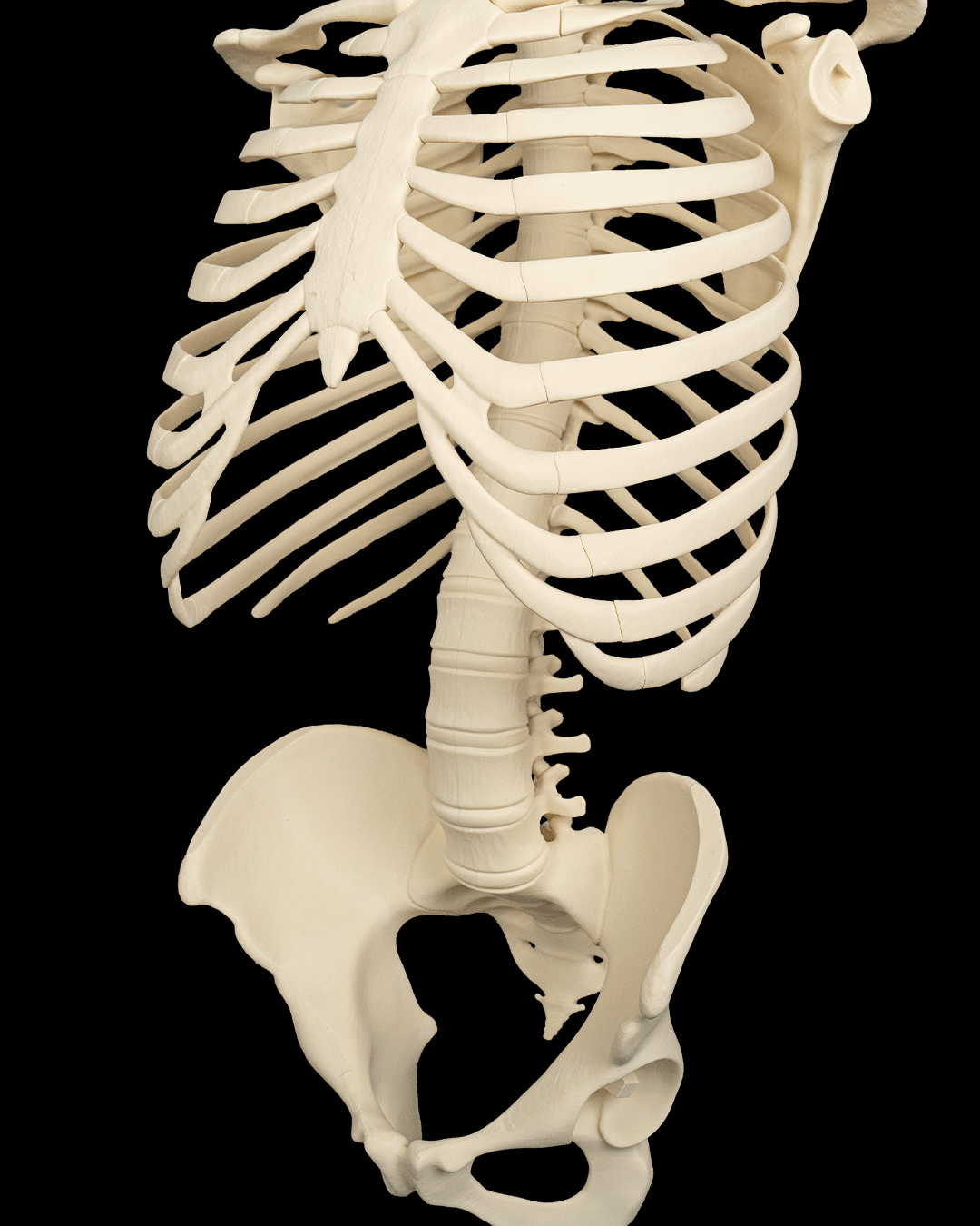 4238 - Rib Cage, Spine & Pelvis