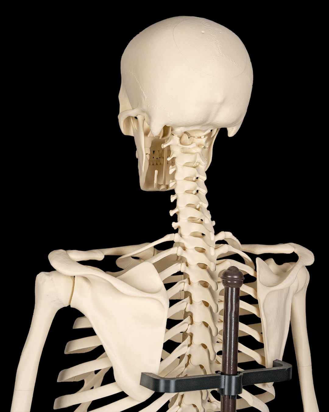 4238 - Rib Cage, Spine & Pelvis