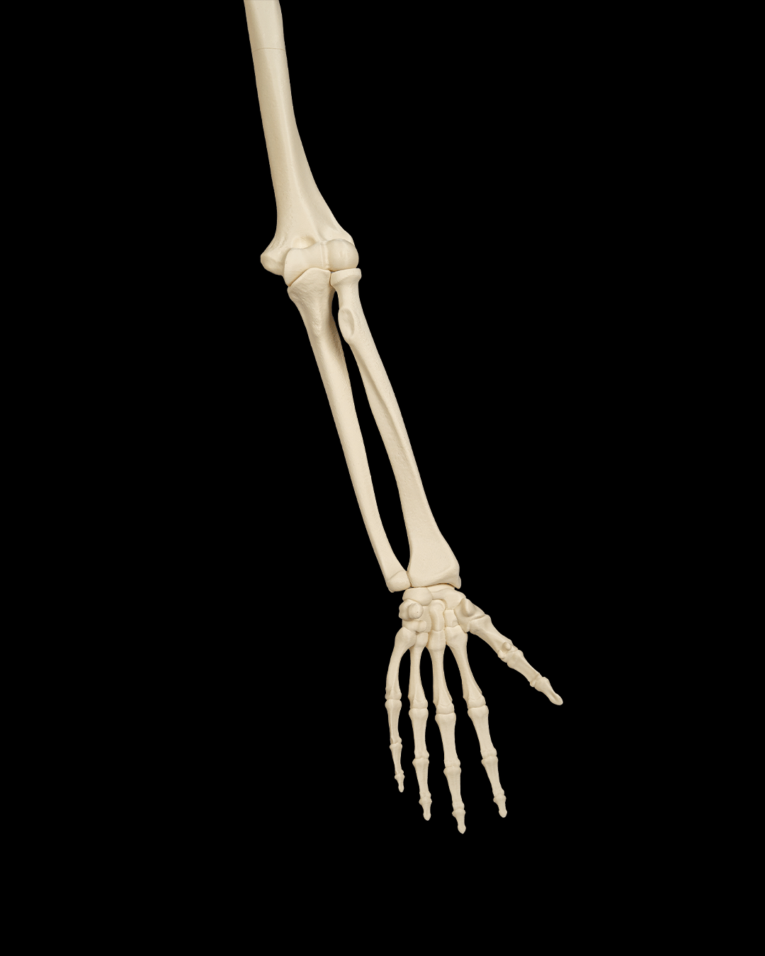 4240 - Upper Limb