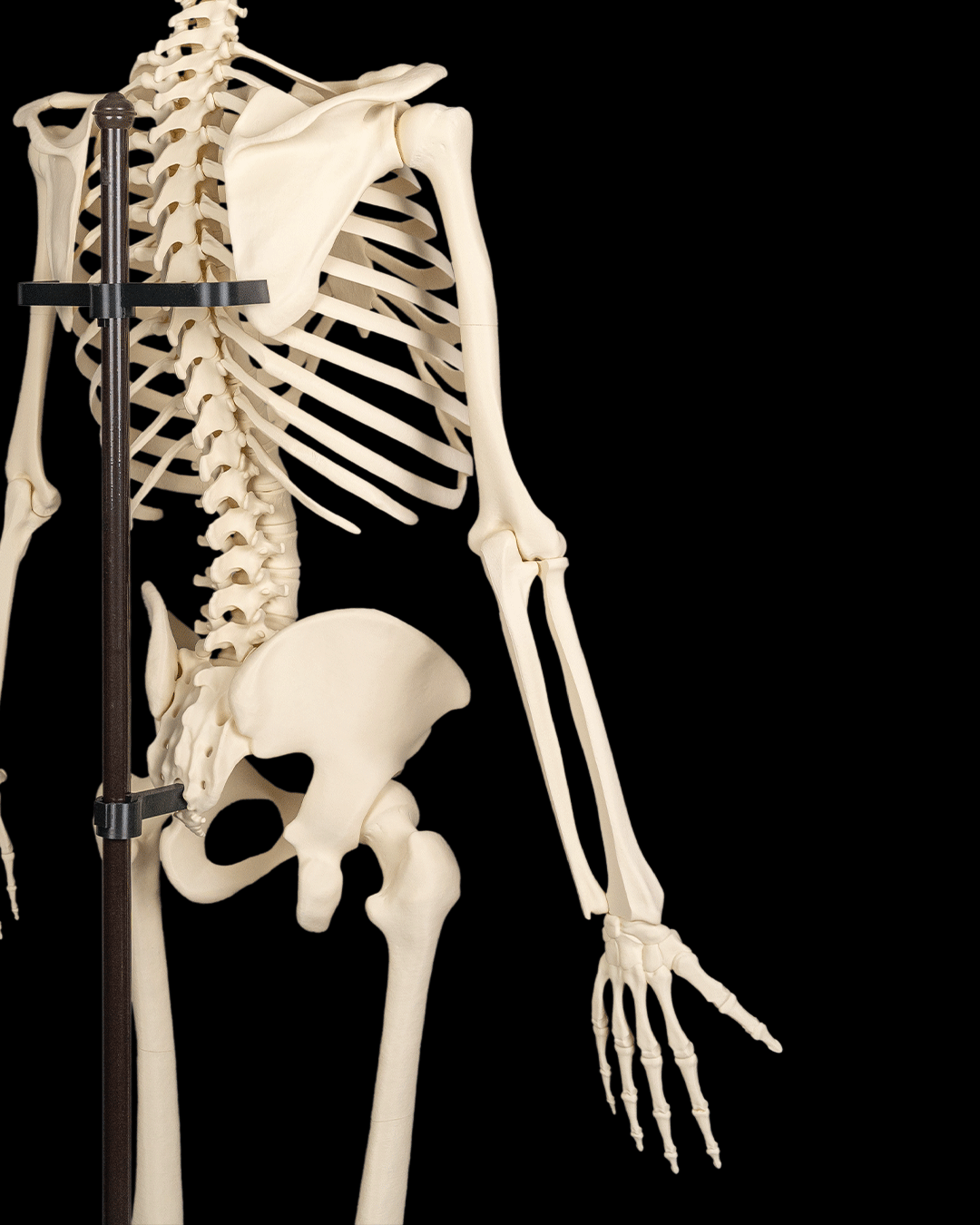 4240 - Upper Limb