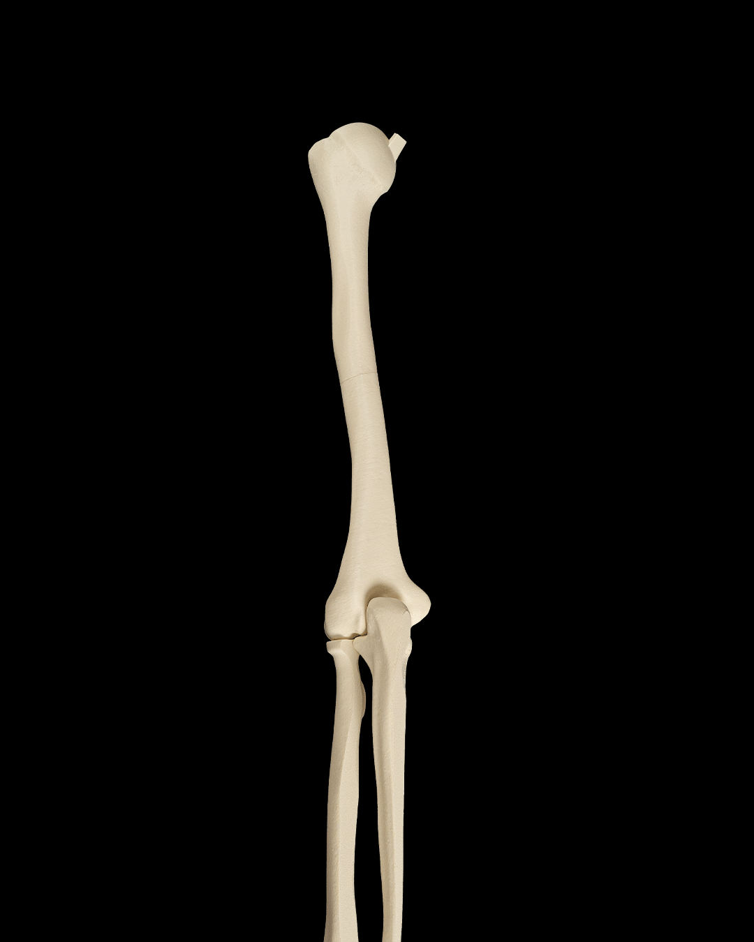 4240 - Upper Limb