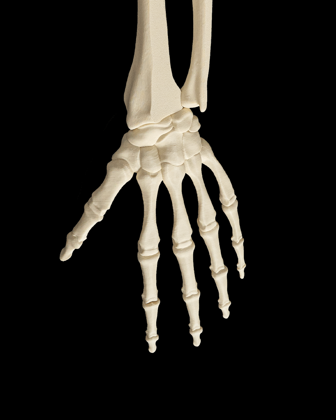 4240 - Upper Limb