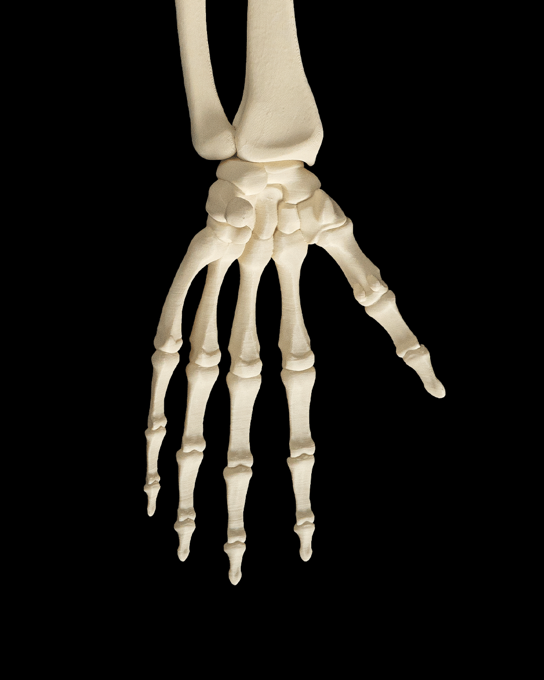 4240 - Upper Limb