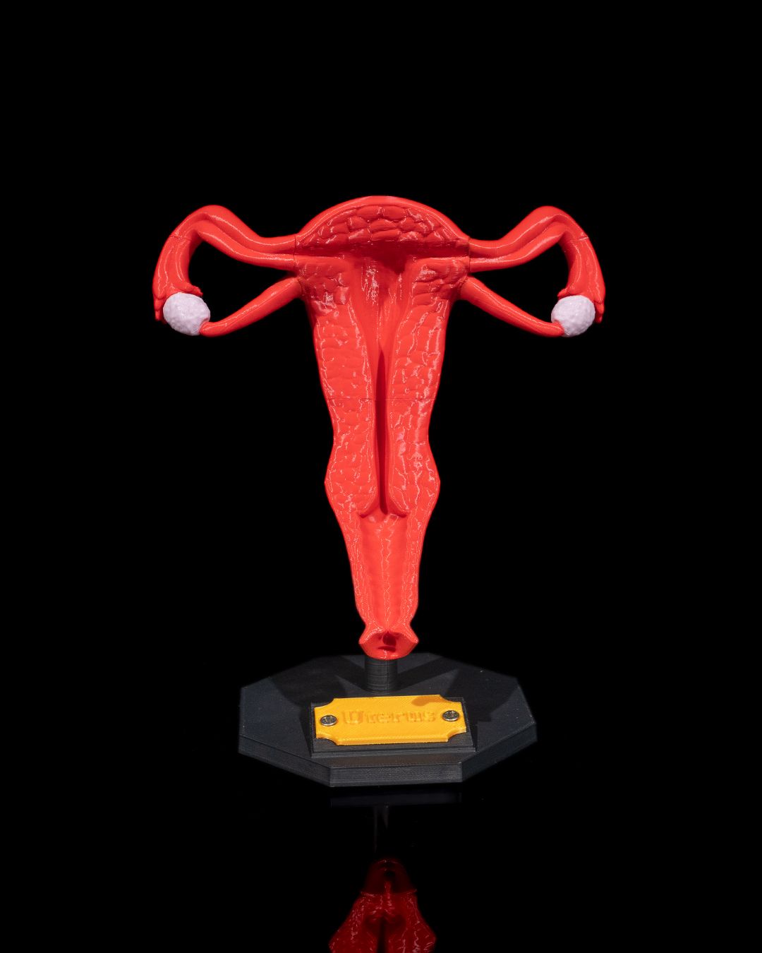 1529 - Uterus