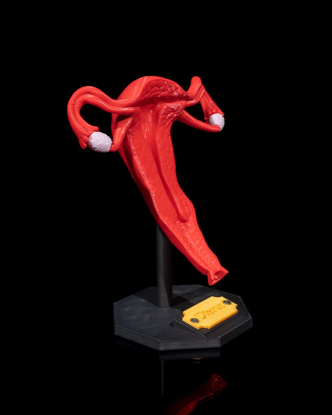 1529 - Uterus