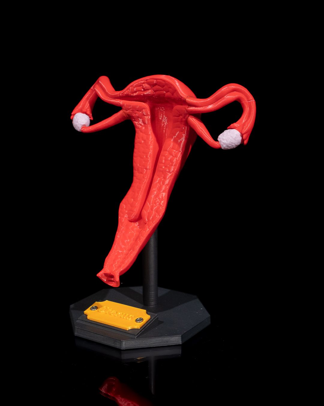 1529 - Uterus