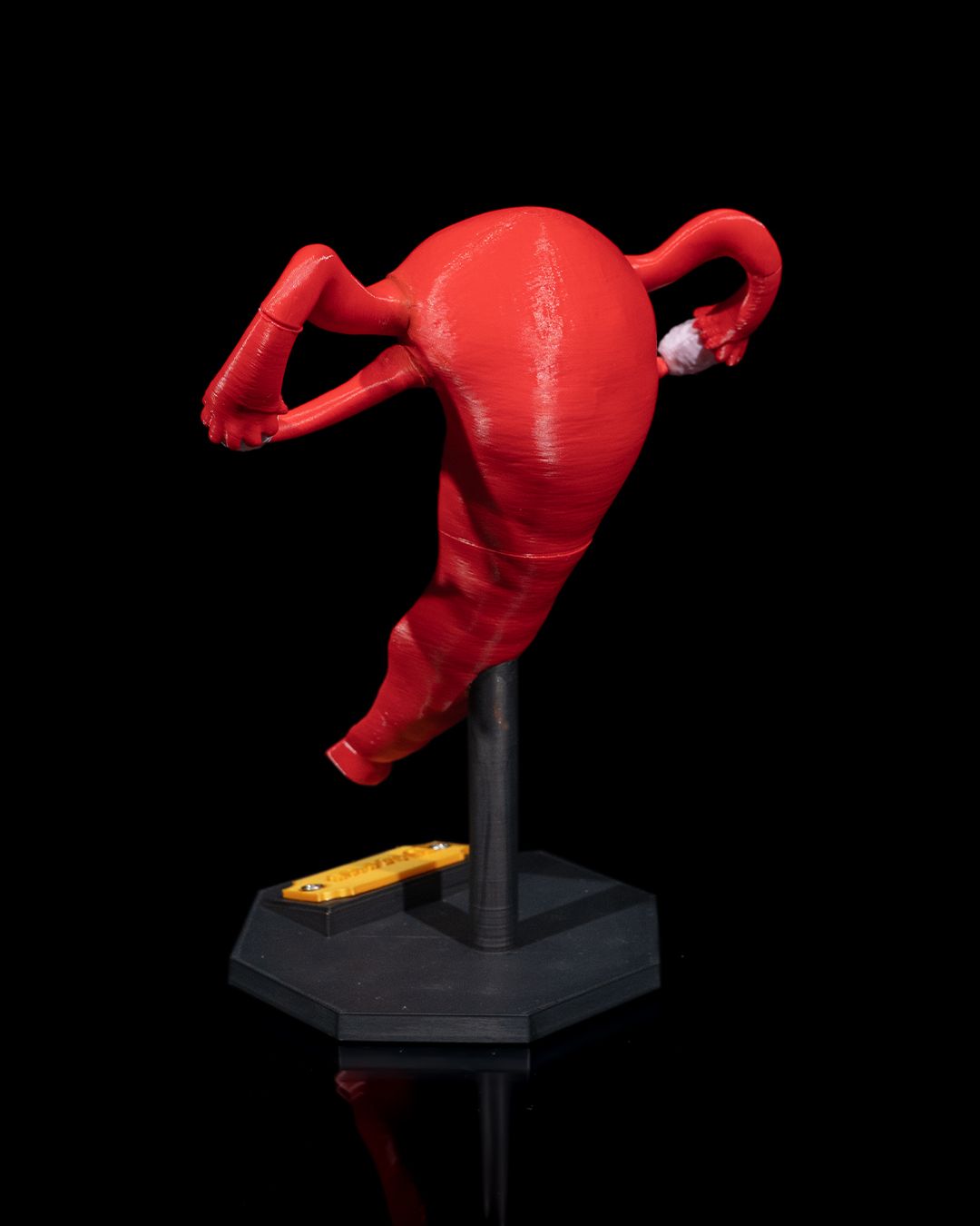 1529 - Uterus
