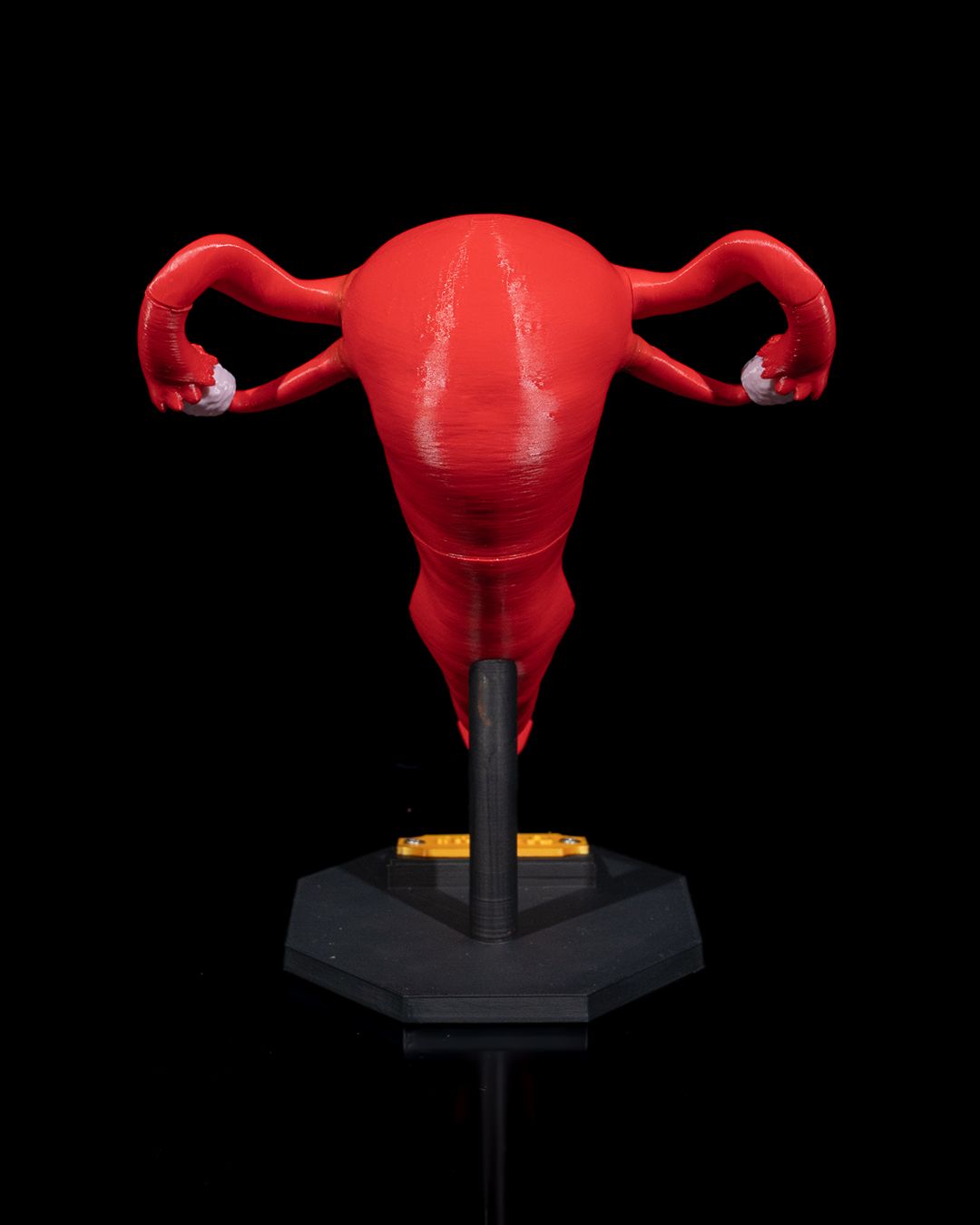 1529 - Uterus